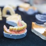 השתלות שיניים ללא השתלת עצם