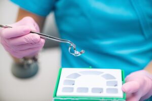 מחיר טיפול שורש