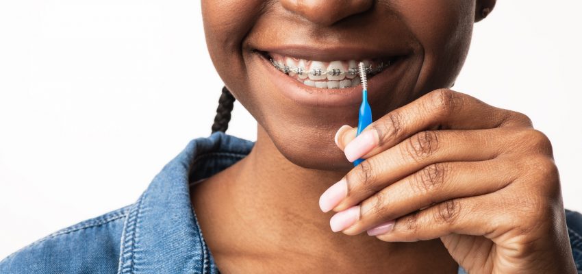 אורתודונטיה יישור שיניים