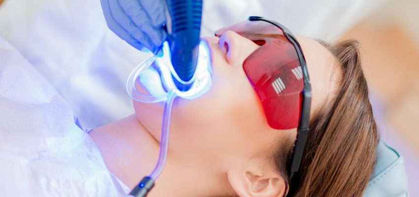 הלבנת שיניים בלייזר